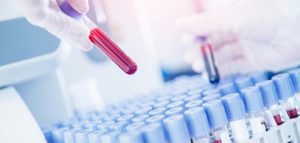 تحليل basophils