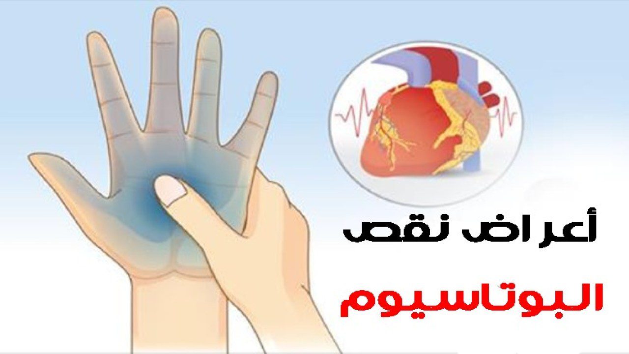 نقص البوتاسيوم ماذا يفعل نقص البوتاسيوم في الجسم