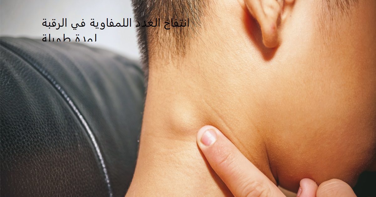 انتفاخ الغدد اللمفاوية في الرقبة لمدة طويلة حجم الغدد اللمفاوية الطبيعي في الرقبة