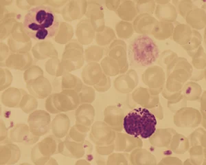 تحليل Basophils